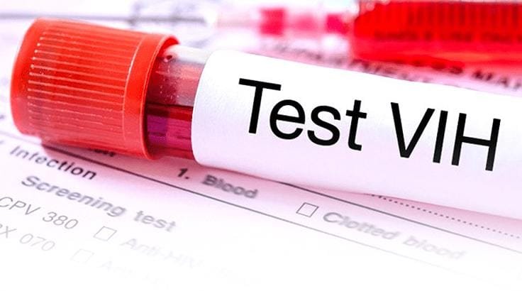 Médica de Chilecito alerta sobre detección de seis nuevos casos de VIH en jóvenes heterosexuales