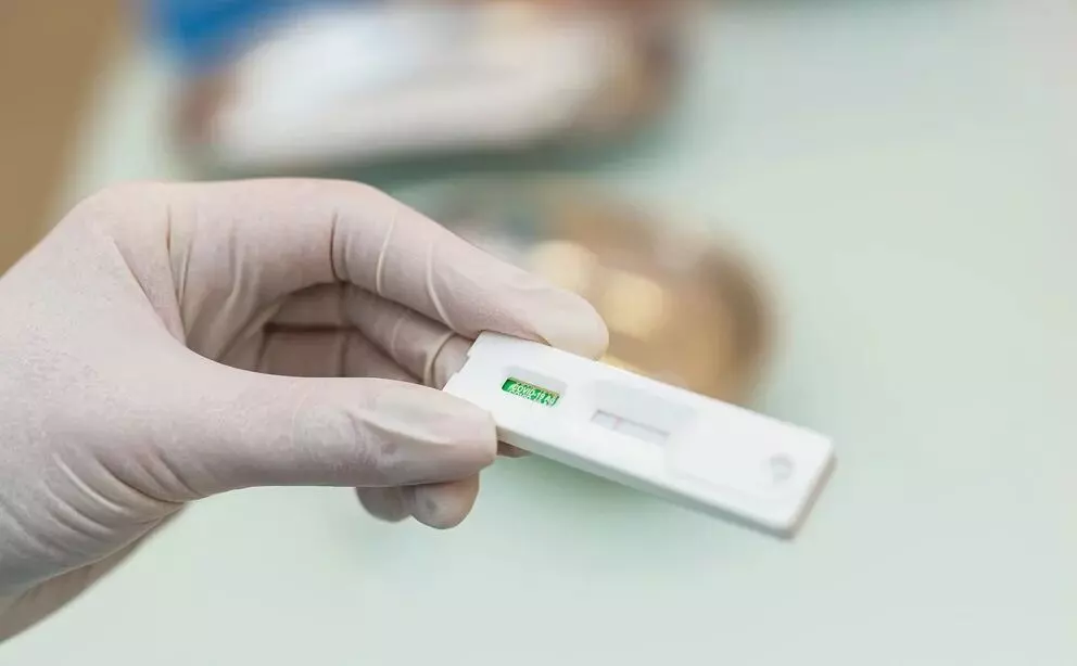 Lanzaron el primer autotest para detectar VIH en nuestro país, que estará disponible en farmacias para facilitar la detección temprana de la enfermedad