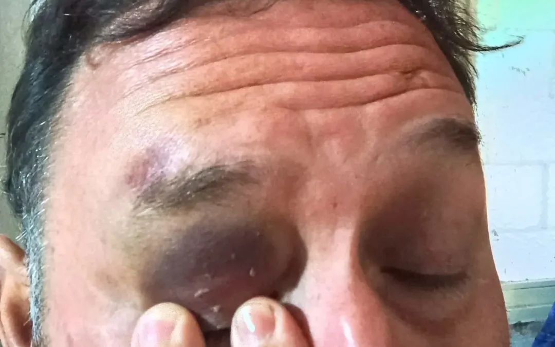 Ciudadano denunció ser agredido y esposado por policías en Nonogasta. Los oficiales habrían intentado evitar la denuncia a cambio de reducirle la multa. Fiscalía investiga el caso