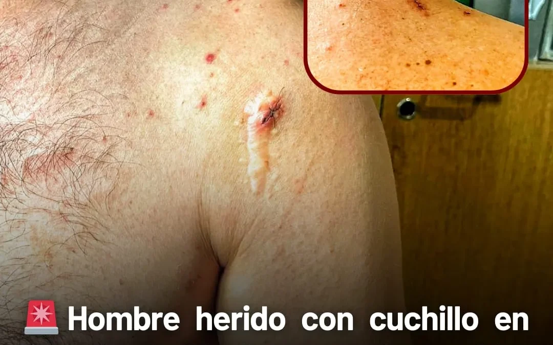 Hombre herido con cuchillo en festejo de Chañarmuyo denunció a su agresor