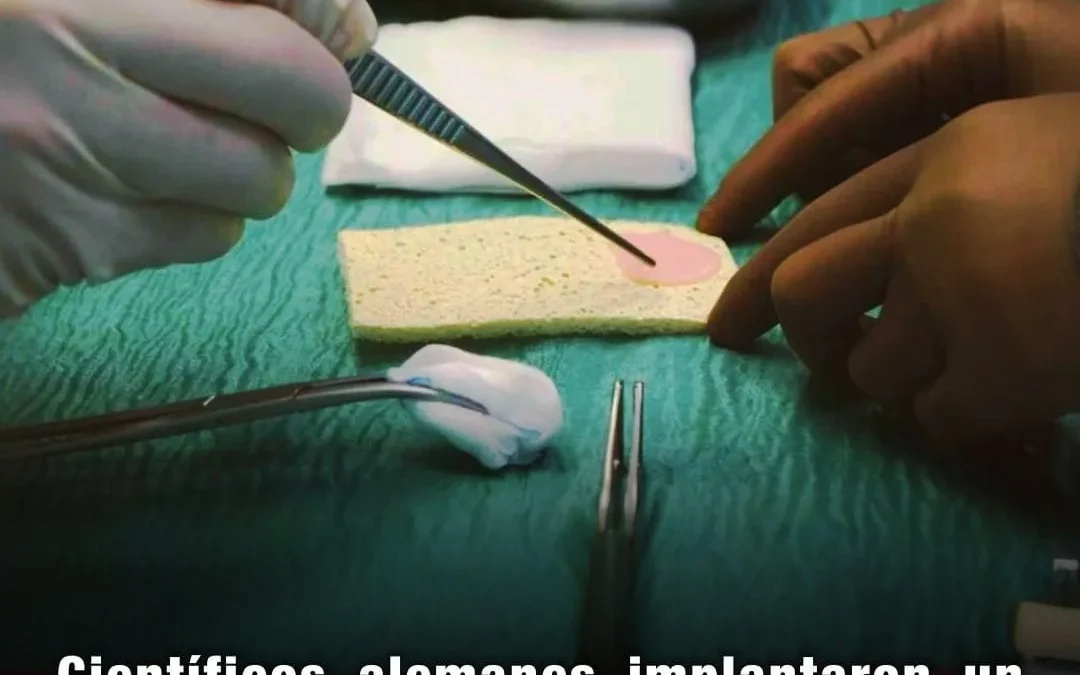 Científicos alemanes implantaron un parche de células madre en un corazón humano, logrando avances en la medicina regenerativa