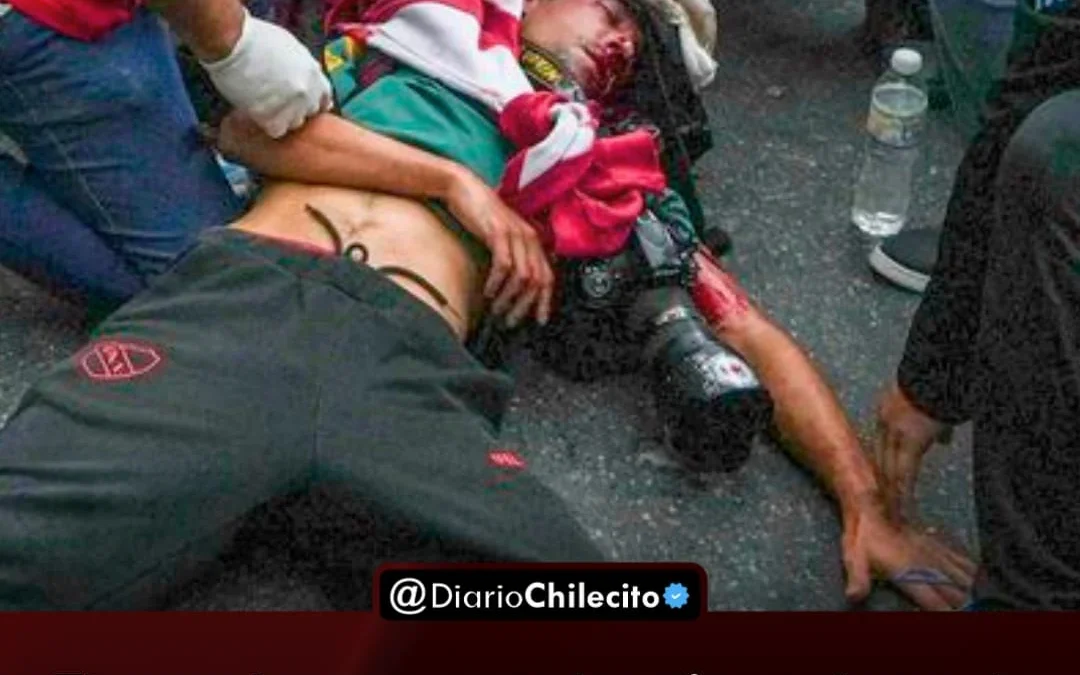 El gendarme que le disparó en la cabeza con una granada de gas al fotógrafo Pablo Granillo fe procesado, pero seguirá en libertad