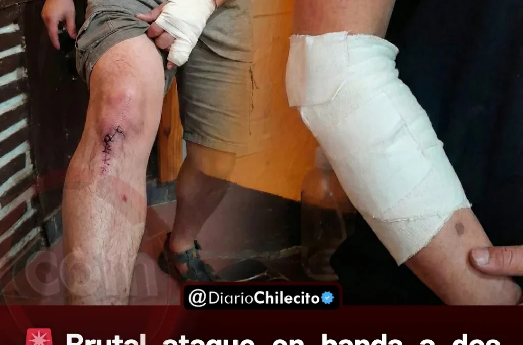 Brutal ataque en banda a dos amigos en Famatina: les robaron celulares y efectivo tras brutal golpiza a la salida de un kiosco