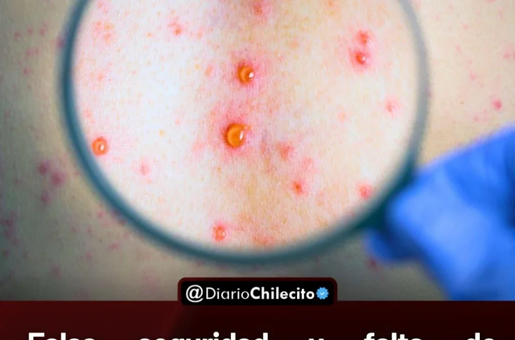 Falsa seguridad y falta de protección: especialistas advierten sobre el fuerte avance de la sífilis en jóvenes.