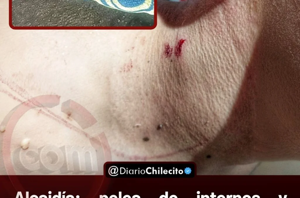 Alcaidía: pelea de internos y amenazas de muerte con un arma casera. Sospechan que uno de ellos se autolesionó para inculpar al otro.