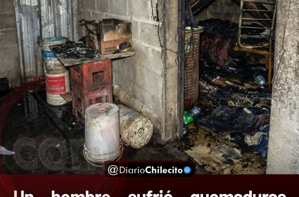 Un hombre sufrió quemaduras graves tras incendiarse por completo su vivienda ubicada en el camino a la localidad de Malligasta.