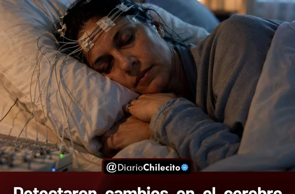 Detectaron cambios en el cerebro durante el sueño profundo y creen que podrían anticipar el Alzheimer años antes de los síntomas.