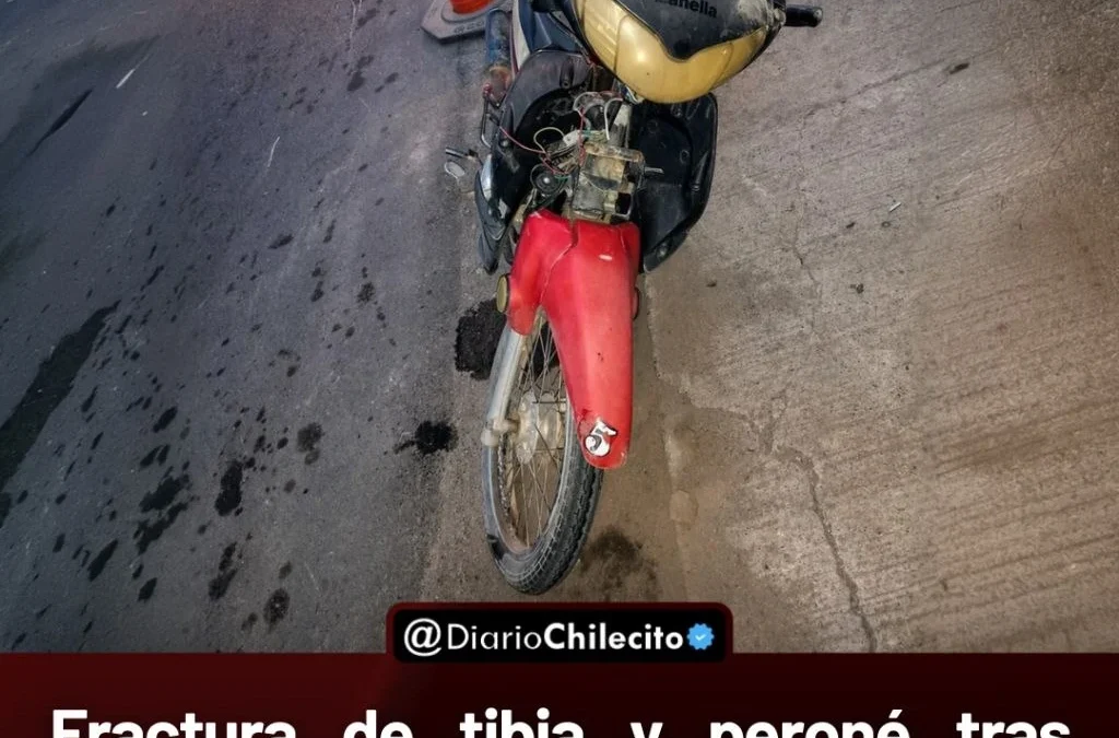 Fractura de tibia y peroné tras impacto en Vichigasta: una joven fue atropellada al cruzar delante de un colectivo.