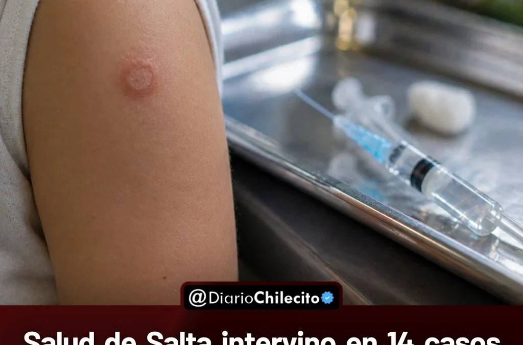 Salud de Salta intervino en 14 casos de padres antivacunas y advierten aumento de tuberculosis en menores de 5 años.