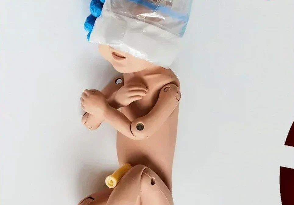 Un mecánico argentino inventó un dispositivo revolucionario para partos que ya se utiliza con éxito en hospitales de Europa.